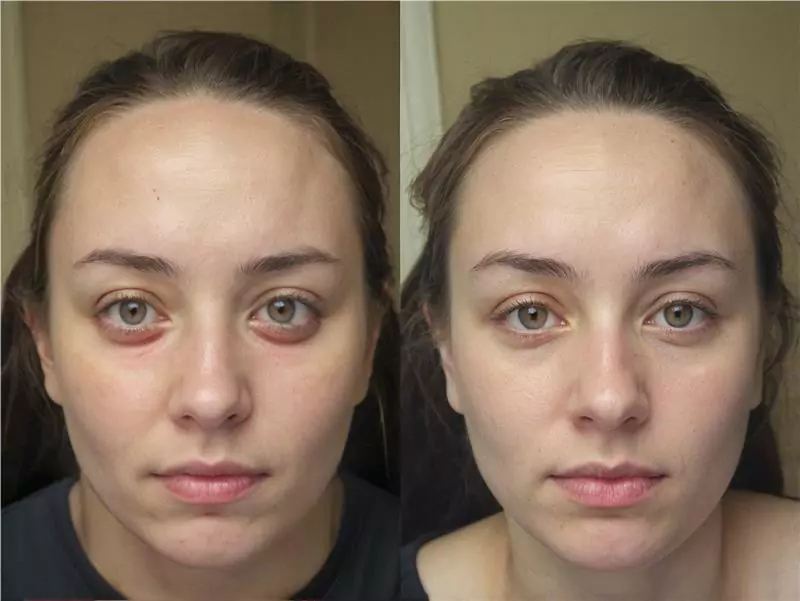 DeepSleep Bliss Reviews 1